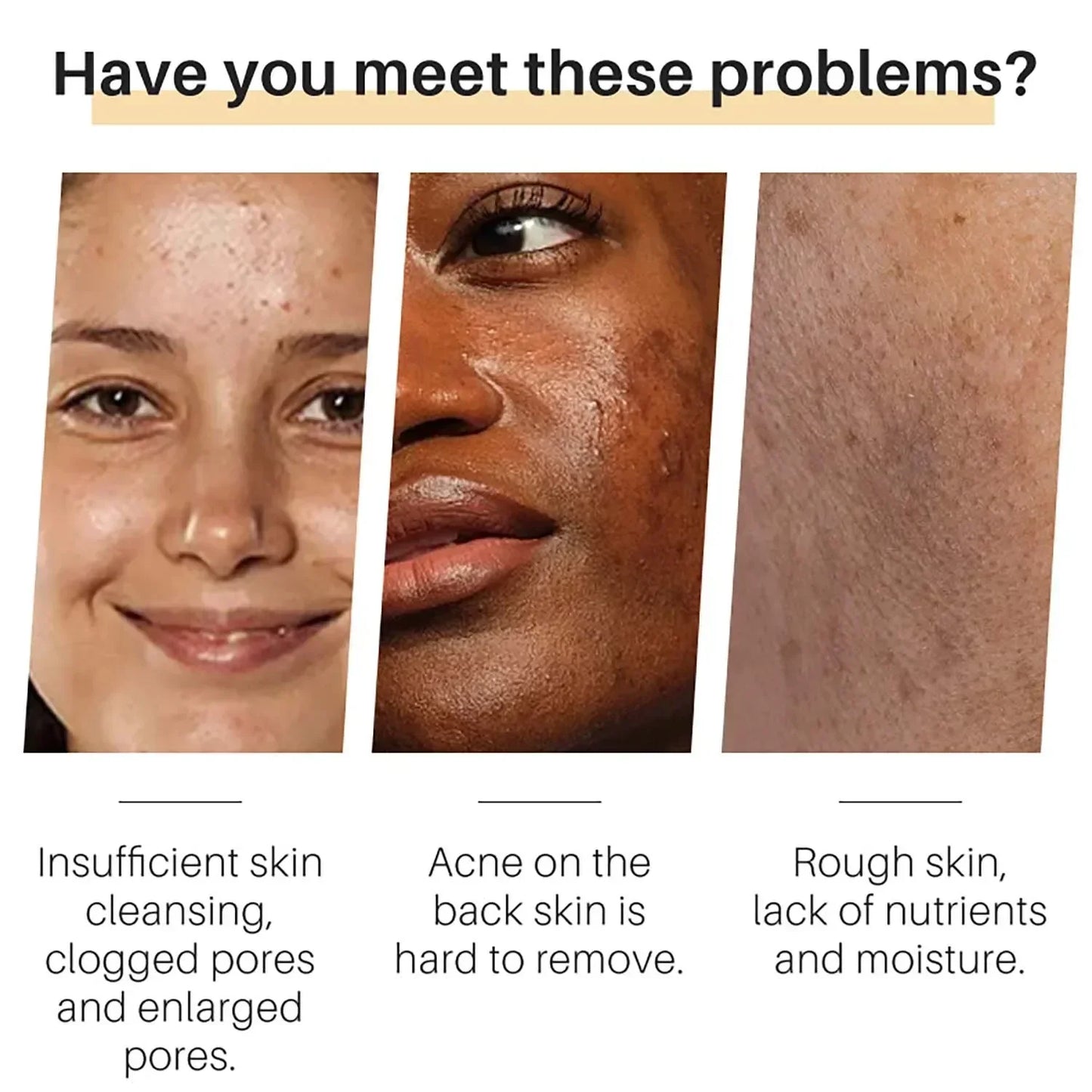 Golden Glow Tumeric Bar – Fades Dark Spots & Evens Skin Tone