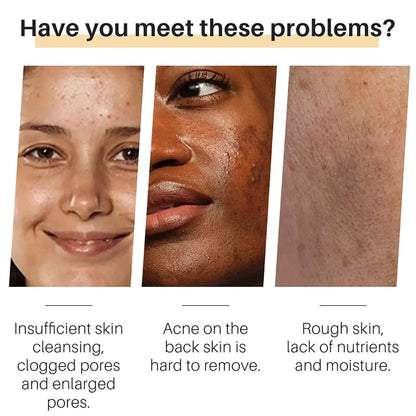 Golden Glow Tumeric Bar – Fades Dark Spots & Evens Skin Tone